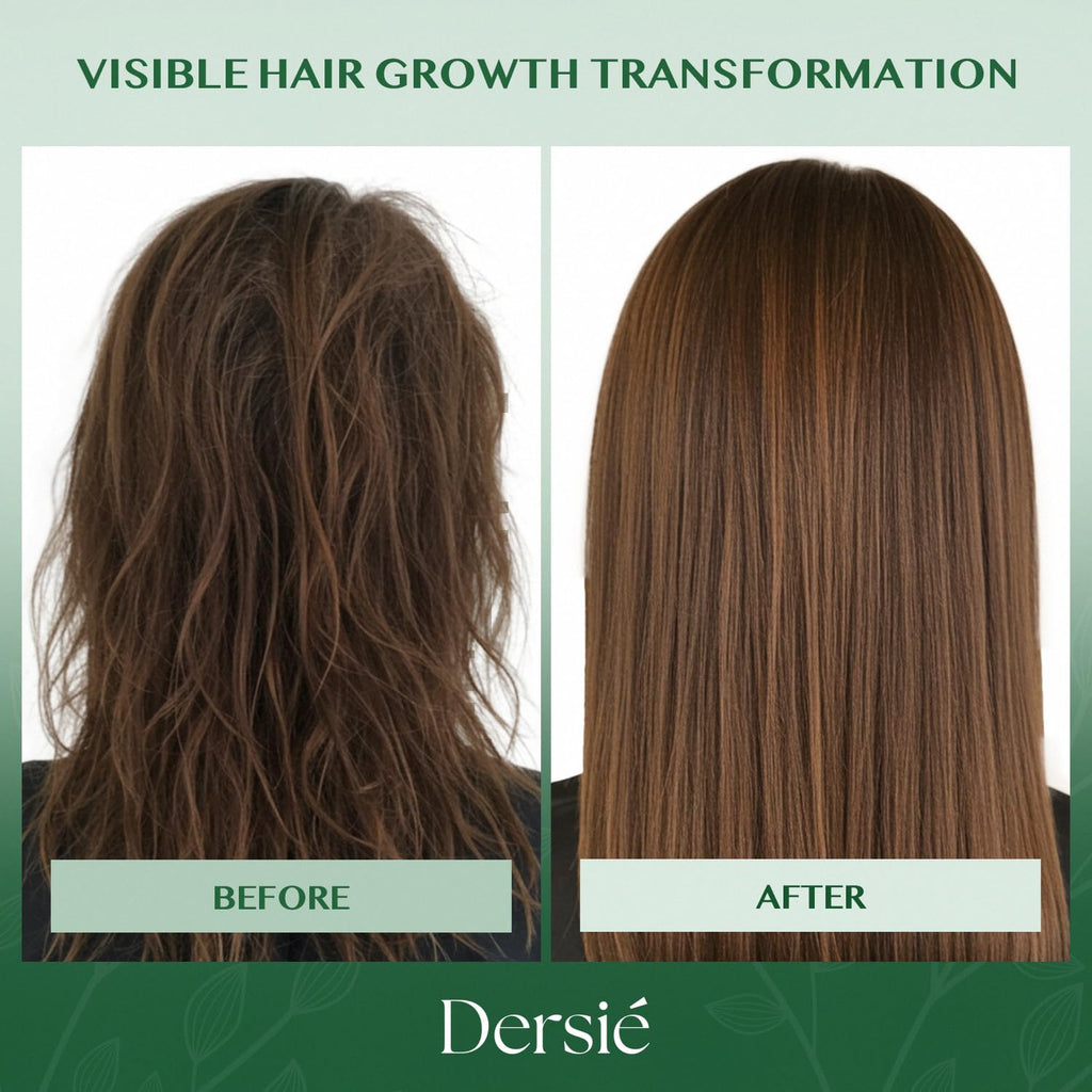 Dersie Batana Oil Hair Growth Conditioner: Infused with Batana Oil & Biotin for Hair Growth – Moisturizing & Nourishing Formula for Thinning, Dry, or Damaged Hair (10 fl oz)