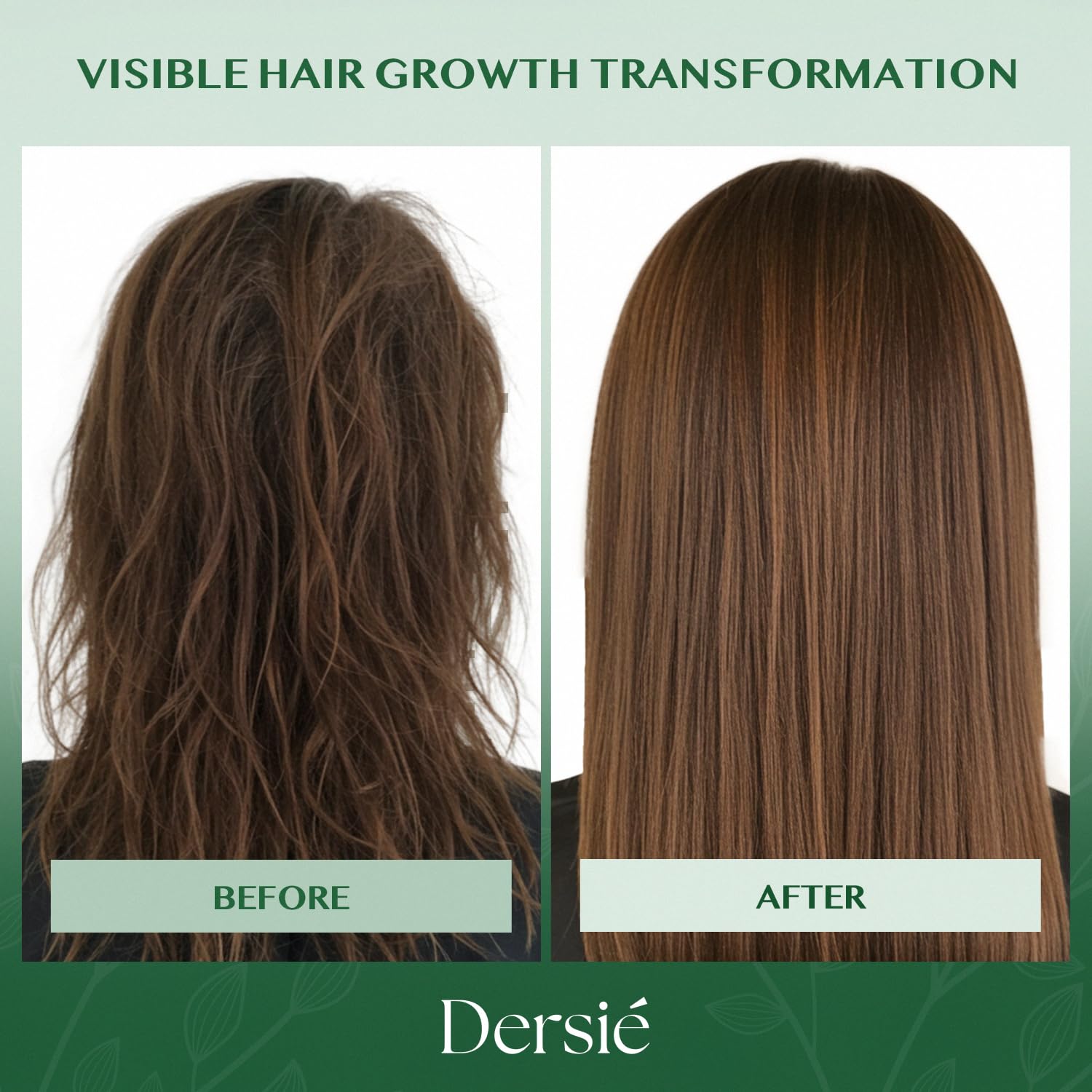 Dersie Batana Oil Hair Growth Conditioner: Infused with Batana Oil & Biotin for Hair Growth – Moisturizing & Nourishing Formula for Thinning, Dry, or Damaged Hair (10 fl oz)