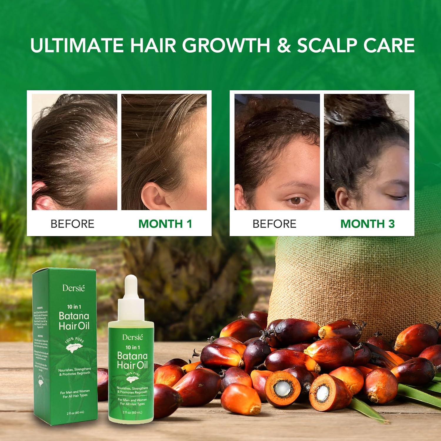 Hair Growth Oil with Batana and Rosemary: 10-in-1 Veganic & Natural Hair Growth Treatment for Hair Loss, Damage & Thinning Hair - 10 Organic Vegan Oils for Men and Women of All Hair Types - 2 fl oz